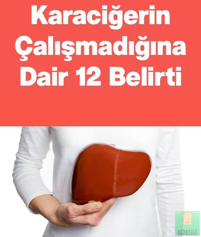 Karaciğerin Çalışmadığına Gösteren 12 Belirti - 1