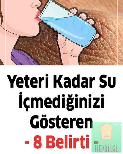 Yeteri kadar su içmediğinizde başınıza bunlar gelir.. >> - 1