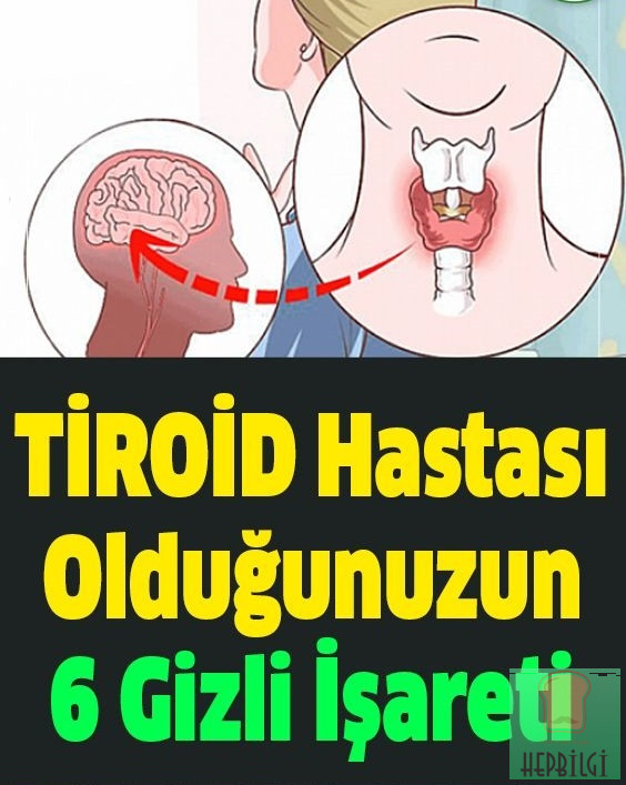 Tiroid Hastası Olduğunuzun 6 Saklı İşareti - 1