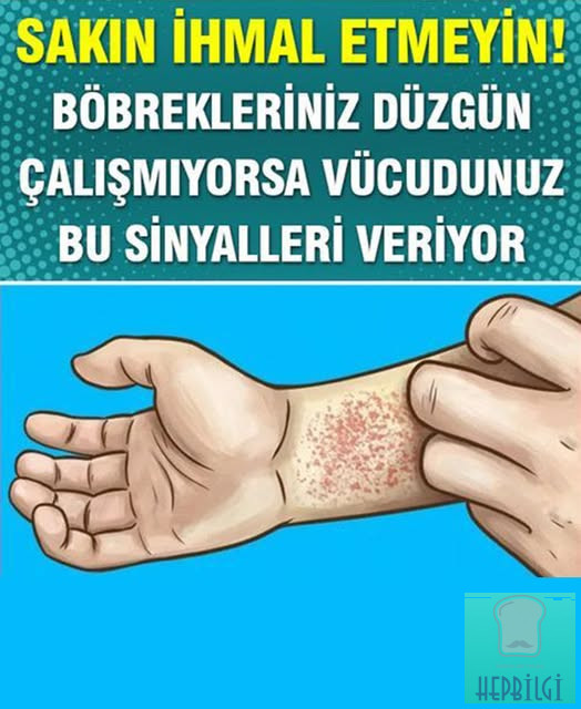 Böbreklerinizin Düzgün Çalışmadığını Gösteren Belirtiler - 1