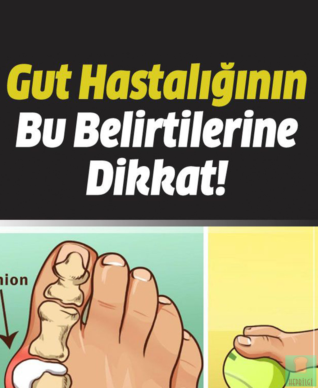 Gut Hastalığının Belirtilerine Dikkat - 1