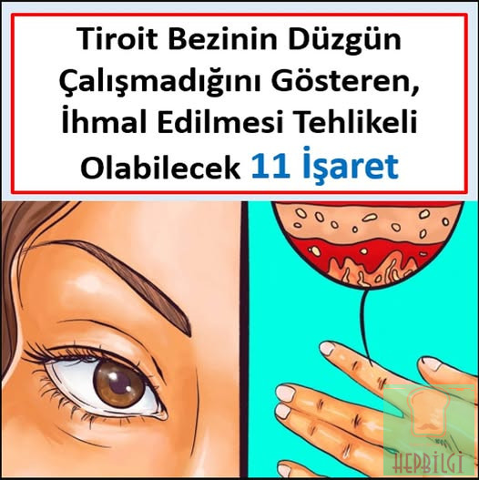 TİROİT BEZİNİN DÜZGÜN ÇALIŞMADIĞINI GÖSTEREN, İHMAL ETMESİ TEHLİKELİ OLABİLECEK 11 İŞARET - 1