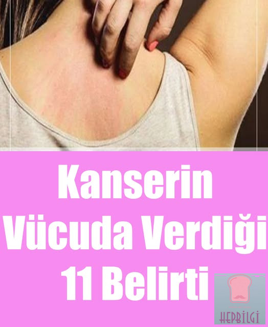 Kanserin Vücuda Verdiği 11 Belirti - 1