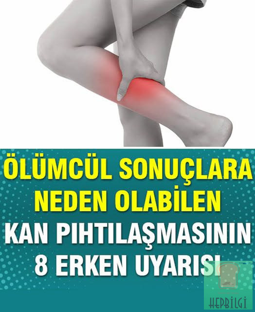 Kan Pıhtılaşmasının 8 Erken Belirtisi - 1