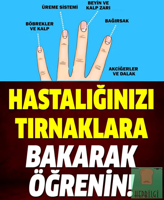 Tırnaklarınızın size anlattığı 13 sağlık sorununa dikkate alın - 1