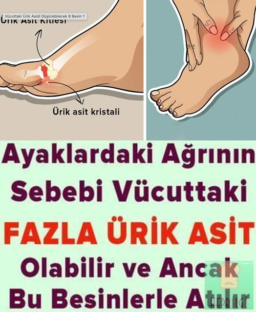 Ayaklardaki Ağrının Sebebi Ürik Asit Olabilir - 1