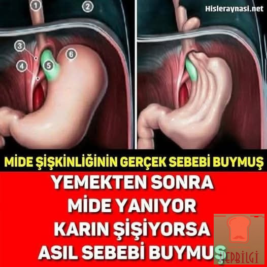 Yemekten Sonra Mide Şişiyorsa Dikkat - 1