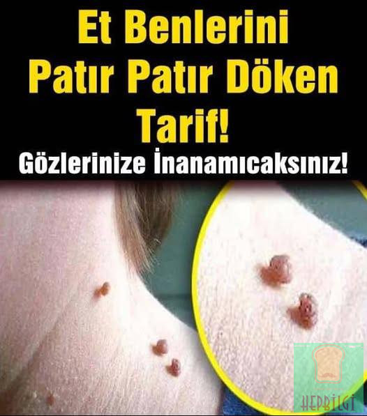 ET BENLERİNİZİ PATIR PATIR DÖKEN - 1