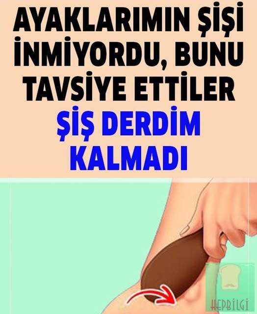 Şişmiş Ayaklar İçin Ne Yapılmalı - 1