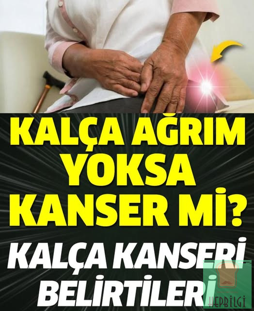 Kalça ağrım kanser mi? Kalça kanseri belirtileri - 1