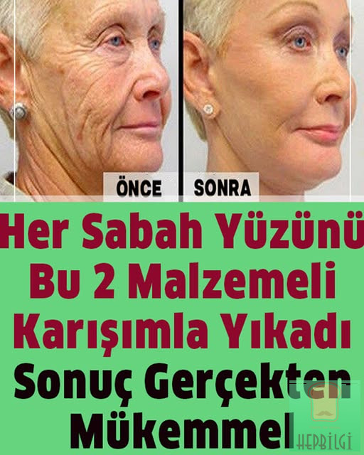 Her Sabah Yüzünüzü Bu 2 Malzemeli Karışımla Yıkayın - 1