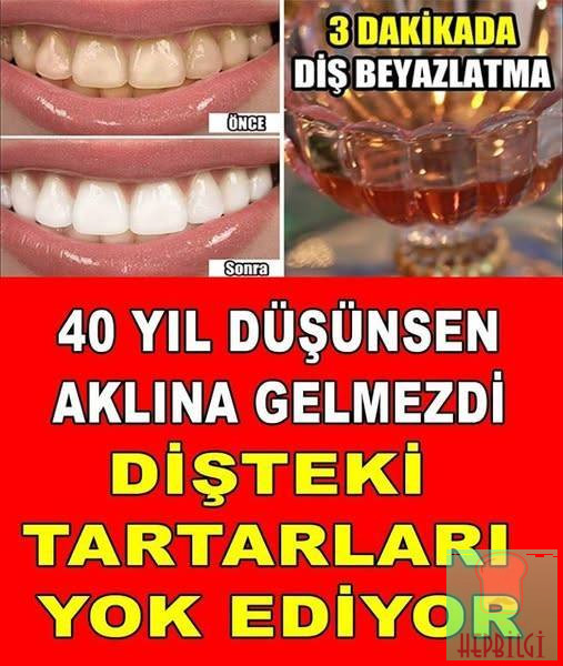 40 SENE DÜŞÜNSENİZ AKLINIZA BİLE GELMEZ DİŞTEKİ PLAĞI TARTARI YOK EDİYOR - 1