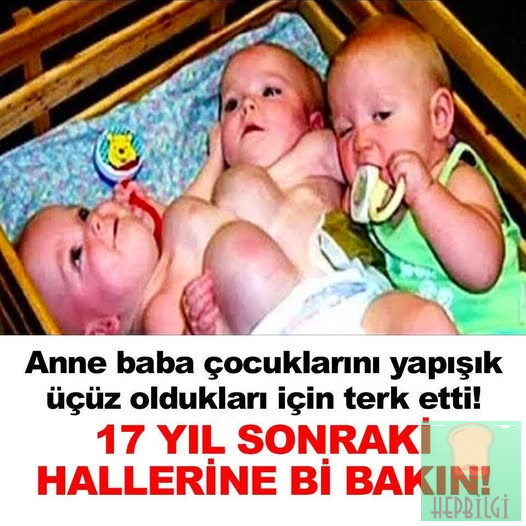 Anne Baba Çocuklarını Yapışık Üçüz Oldukları İçin Terk Etti 17 Yıl Sonraki Hallerine Bir Bakın - 1