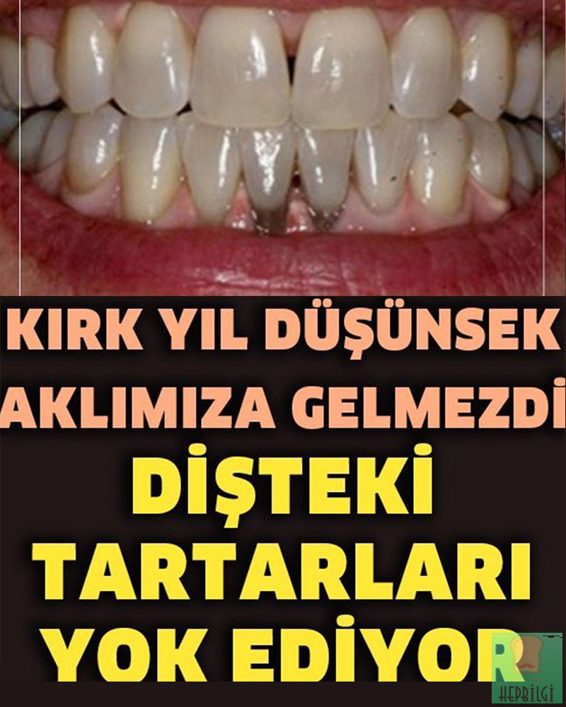 Evde Tartar Lekelerinden Nasıl Kurtulursunuz? - 1