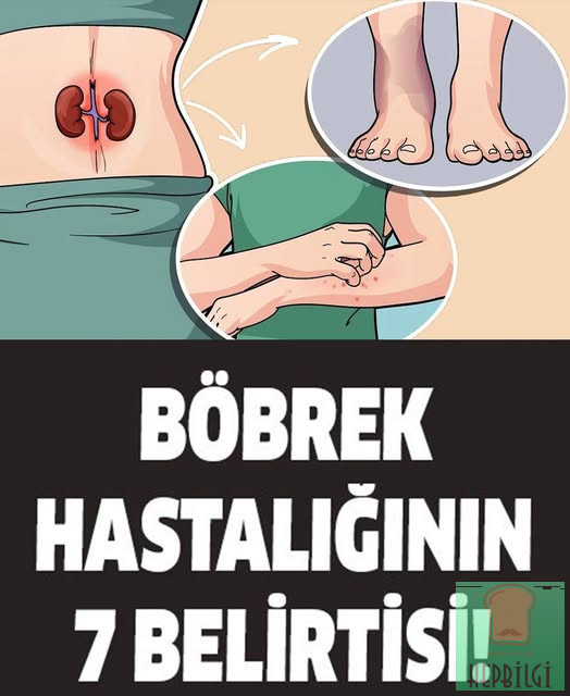 Böbrek Hastalığının 7 Belirtisi - 1