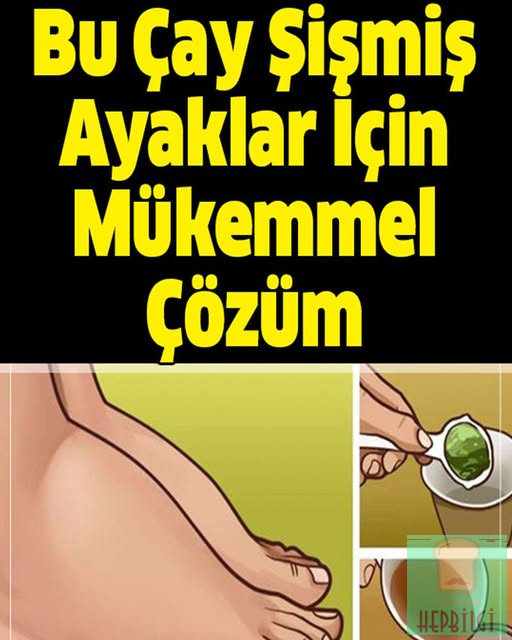 Bu Çay Şişmiş Ayaklar İçin Mükemmel Çözüm - 1