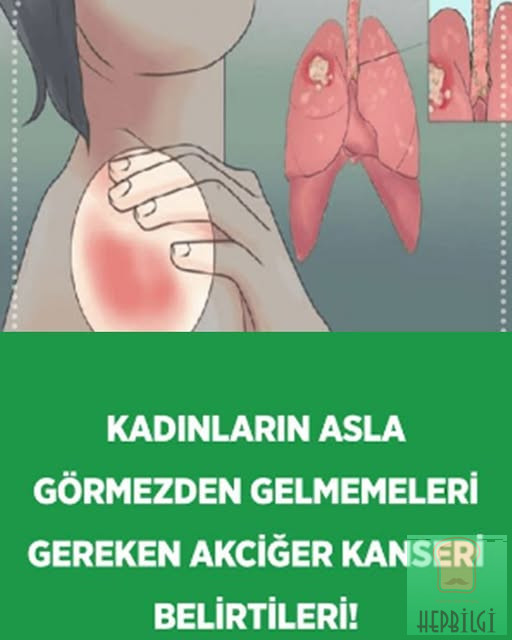 Kadınlarda belirtileri nelerdir - 1