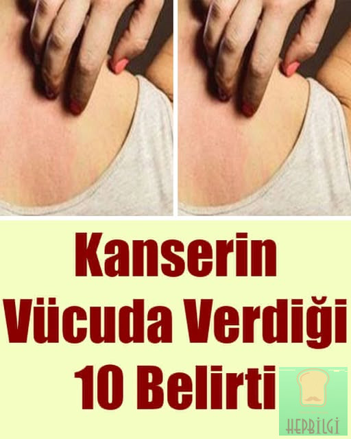 Kanserin Vücuda Verdiği 10 Belirti - 1