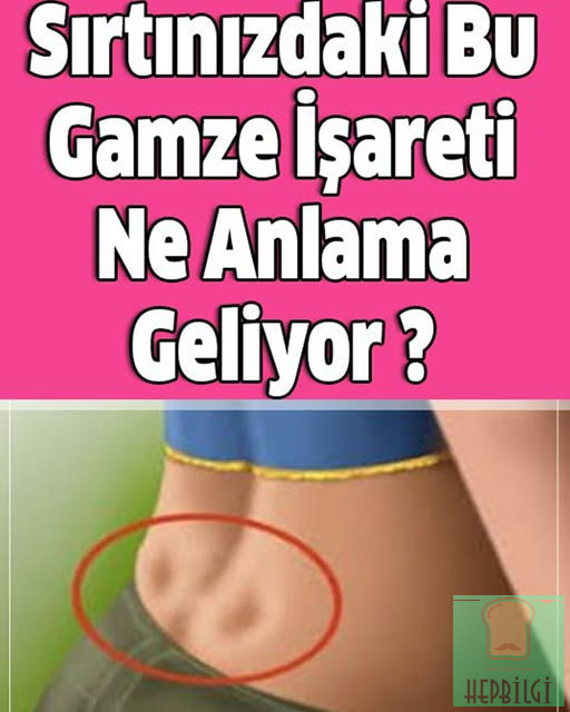 Sırtınızdaki Bu Gamze İşareti Ne Anlama Geliyor - 1