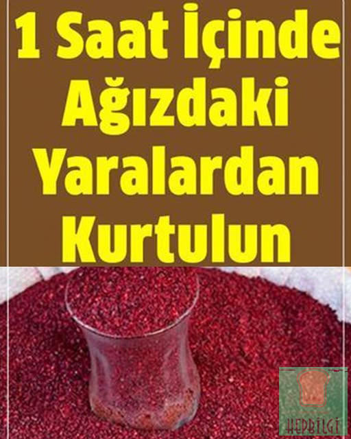 Ağızdaki Yaraları 1 Saat İçinde Yok Ediyor - 1