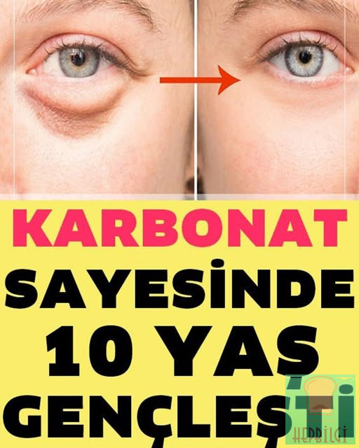 Karbonat İle 10 Yaş Genç Görünün - 1