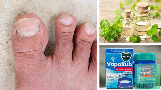 Vicks Nasıl ve Nerede Kullanılır - 4