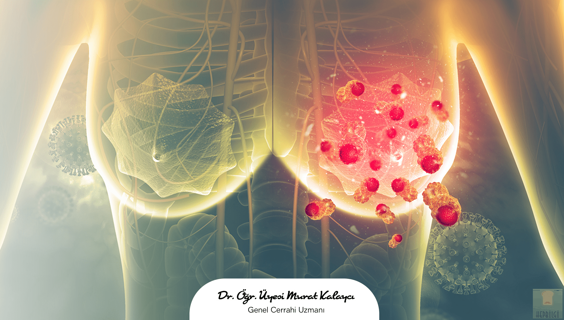 En Çok Rastlanan Meme Kanseri Belirtileri - 2