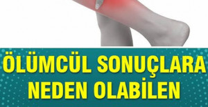 Kan Pıhtılaşmasının 8 Erken Belirtisi	