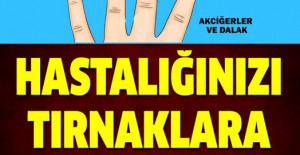 Tırnaklarınızın size anlattığı 13 sağlık sorununa dikkate alın