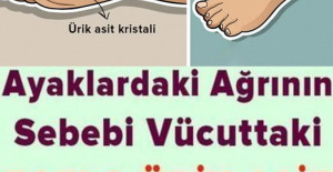 Ayaklardaki Ağrının Sebebi Ürik Asit Olabilir	