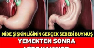Yemekten Sonra Mide Şişiyorsa Dikkat