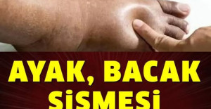 Ayak Bacak Şişmesi Neyin Belirtisi	