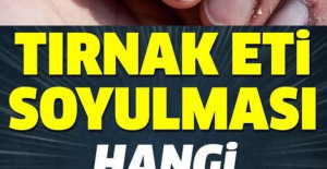 Tırnak Soyulması Hangi Hastalığın Belirtisi	