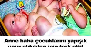 Anne Baba Çocuklarını Yapışık Üçüz Oldukları İçin Terk Etti 17 Yıl Sonraki Hallerine Bir Bakın 