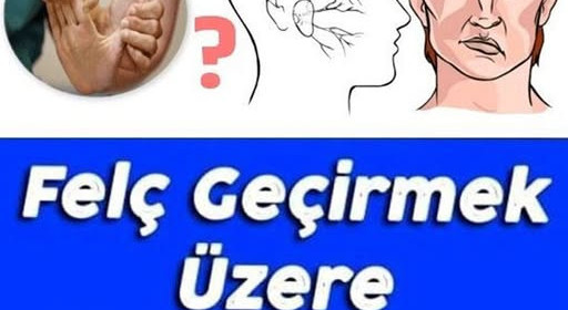 Felç Geçirmek Üzere Olduğunuzun 8 İşareti 