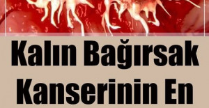 Kalın Bağırsak Kanserinin En Büyük Bulgusu 