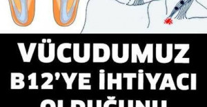 Vücudumuz B12’ye İhtiyacı Olduğunu Böyle Anlatır.