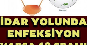 İdrar Yolu Enfeksiyonunu Geçiren 7 Doğal Yöntem 