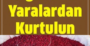 Ağızdaki Yaraları 1 Saat İçinde Yok Ediyor