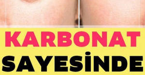 Karbonat İle 10 Yaş Genç Görünün	