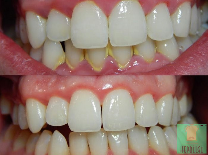 Evde Tartar Lekelerinden Nasıl Kurtulursunuz? - 4