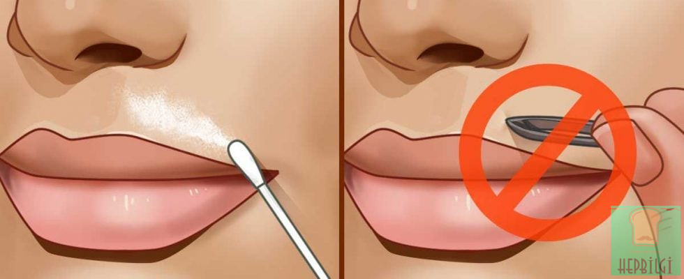 Dudağınızın Üstündeki Tüyleri Yok Eden Doğal Yöntem - 3