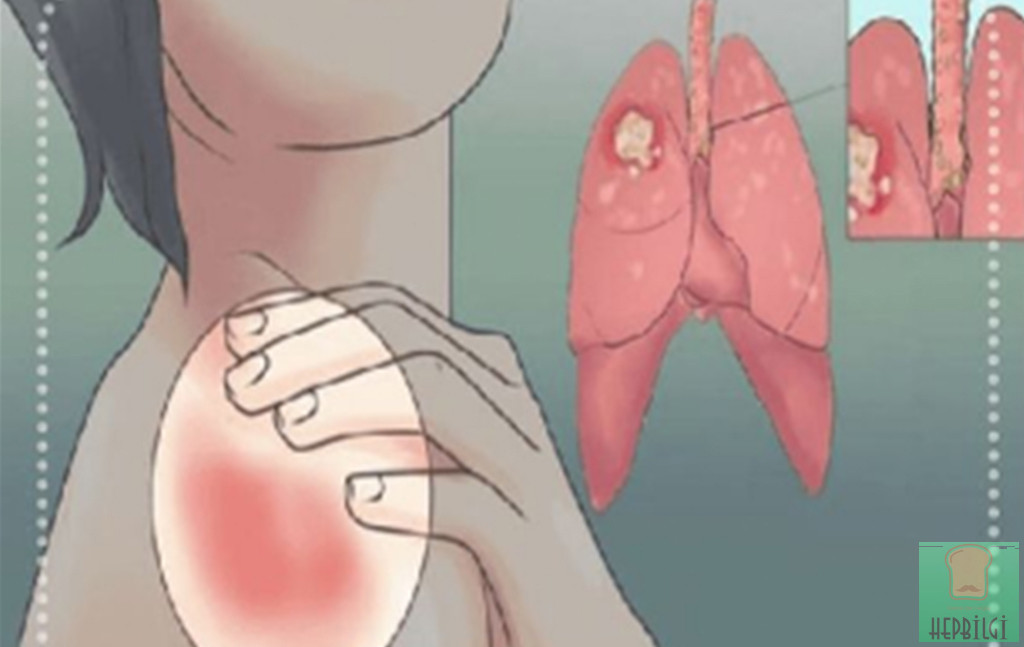 Kadınlarda belirtileri nelerdir - 3