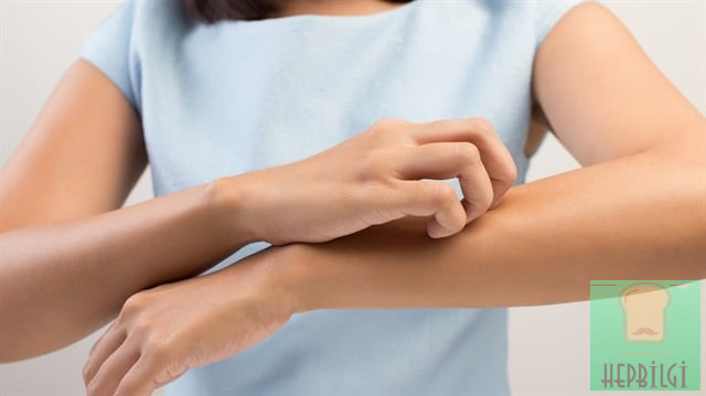 Karaciğerin Çalışmadığına Gösteren 12 Belirti - 3