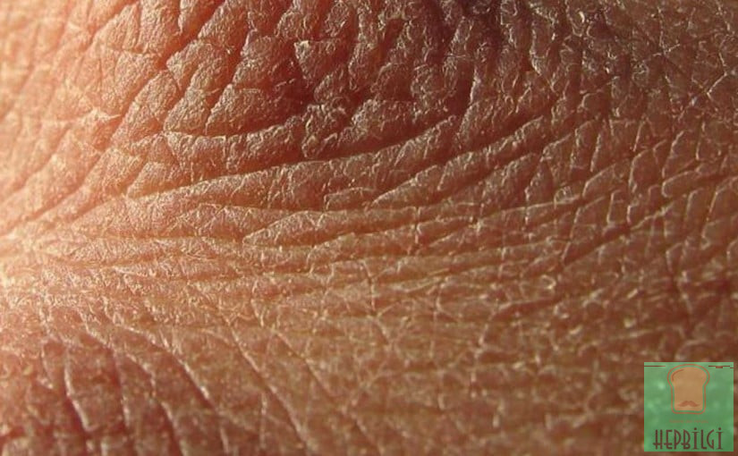 Tiroid Hastası Olduğunuzun 6 Saklı İşareti - 4